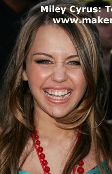 Miley Veneers