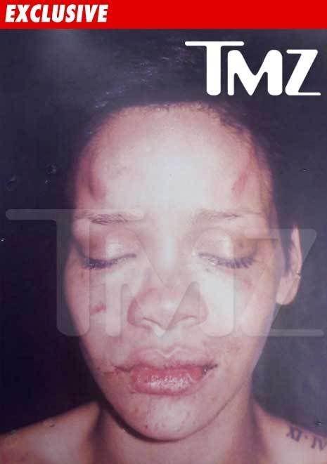 pictures of rihanna beat up. here thanks Tmz, here thanks Real+rihanna+eat+up+pictures