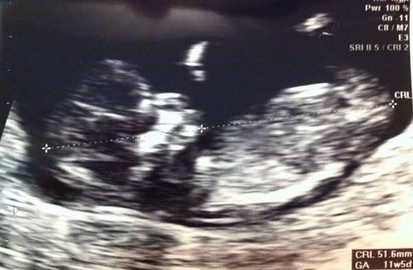 12 weeks