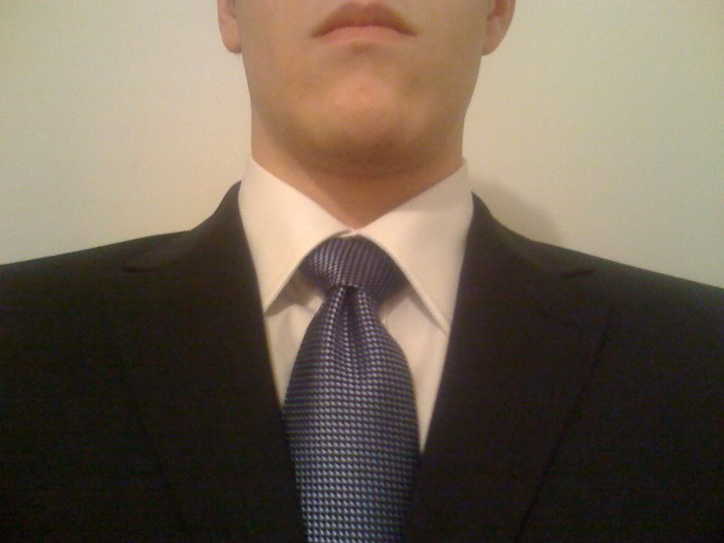 shirt collar condition