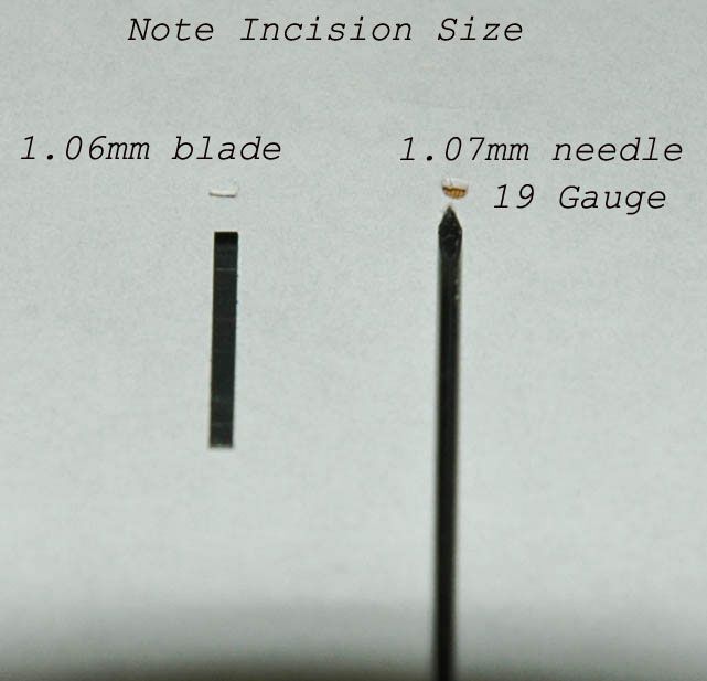 19-gauge-vs-1mm-blade_zpskgbmc2ho