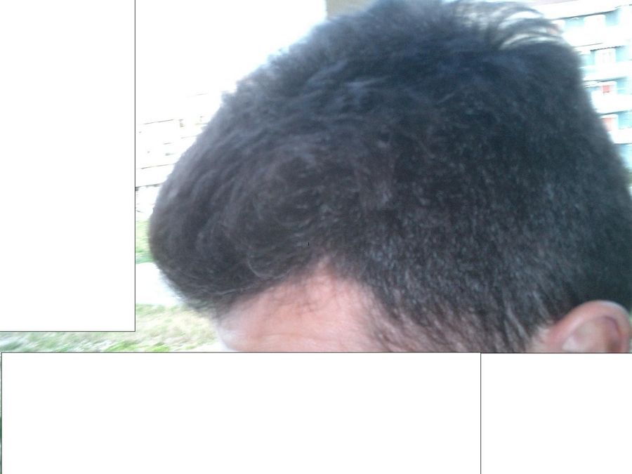 tn_profilosx-esterna-capelliasciuttietiratiindietro